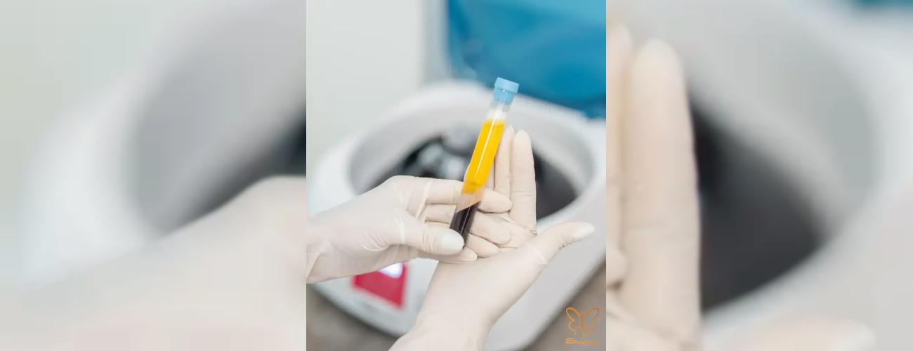 تعداد جلسات PRP مو چقدر است؟  راهنمای کامل کلینیک شاپرک طلایی مشهد