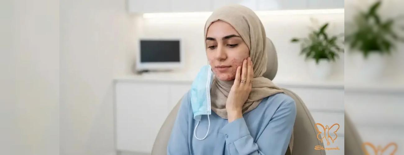 درمان قطعی ماسکنه ، جوش های ناخواسته ناشی از  استفاده طولانی مدت از ماسک صورت 