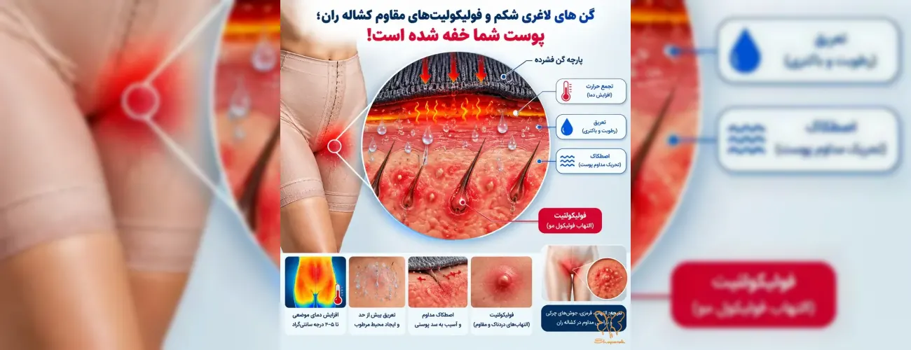 گن‌های لاغری شکم و فولیکولیت‌های مقاوم کشاله ران؛ پوست شما خفه شده است!