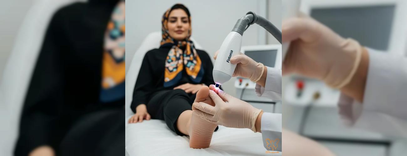 لیزر قارچ ناخن با فوتونا: سریع‌ترین و قطعی‌ترین راه درمان در کلینیک شاپرک طلایی مشهد