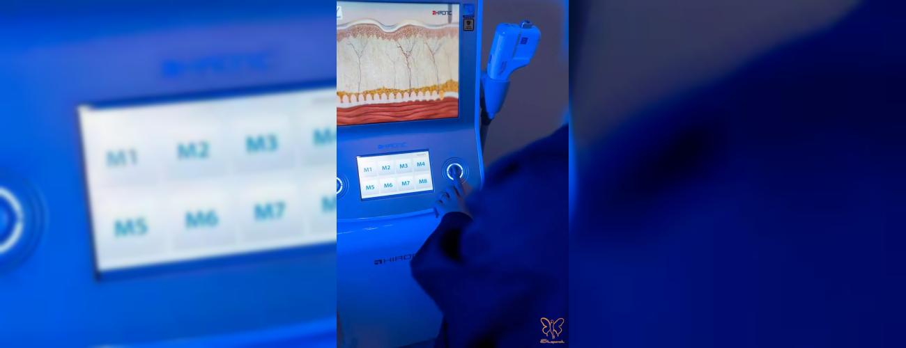 جدیدترین روش‌ جوانسازی صورت با هایفو دابلو گلد ۲۰۲۳ در مشهد