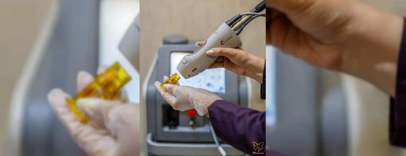 دستگاه الکساندرایت کندلا ، مناسب چه نوع پوستی (روشن، تیپ ۱ تا ۳)