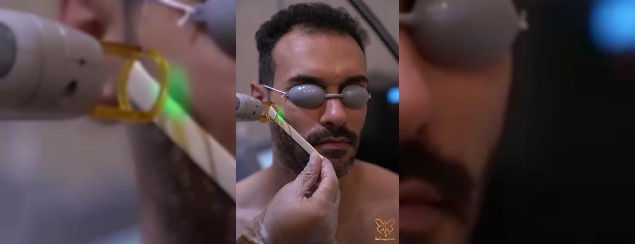 راه‌حلی طبیعی برای پوستی صاف برای آقایون 