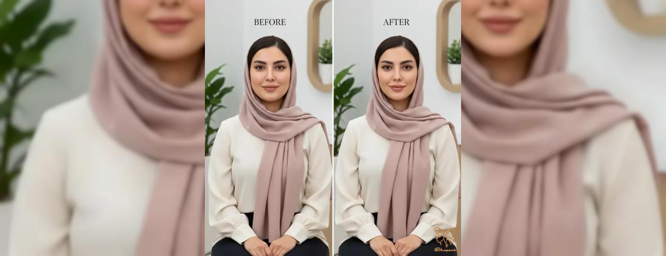 خداحافظی با صورت گرد! لاغری و زاویه سازی صورت با مزوتراپی در کلینیک شاپرک طلایی مشهد