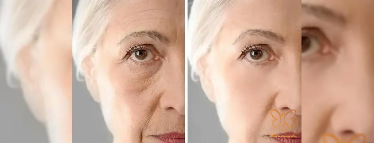 اگر از عمل های زیبایی تهاجمی می‌ترسید، نانوفت بهترین انتخاب شماست!
