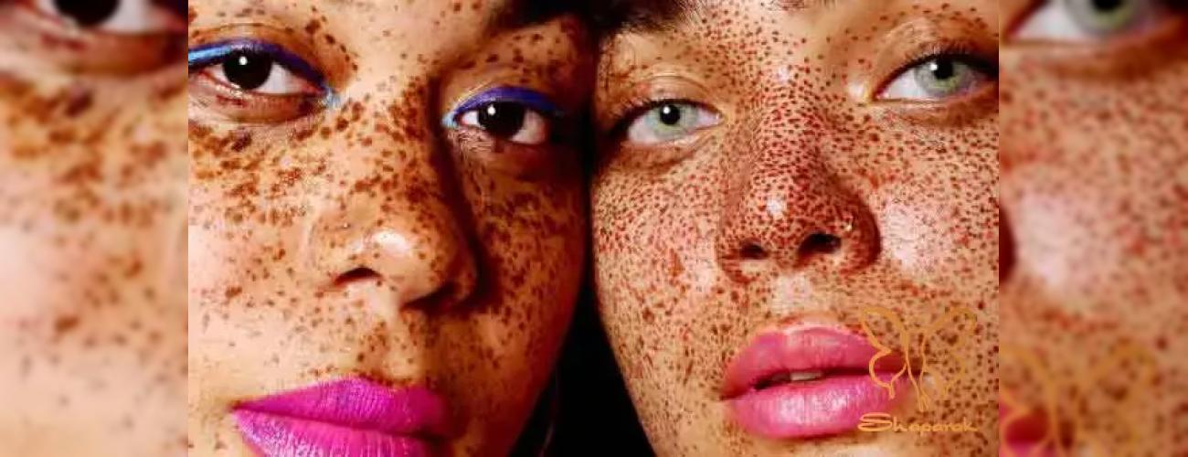 تفاوت کک و مک با ملاسما چیست؟ راهنمای کامل شاپرک طلایی