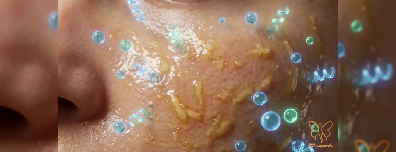 ماسک سیب‌ زمینی و عسل یا خدمات کلینیکی؟ بهترین روش رفع لک صورت در مشهد