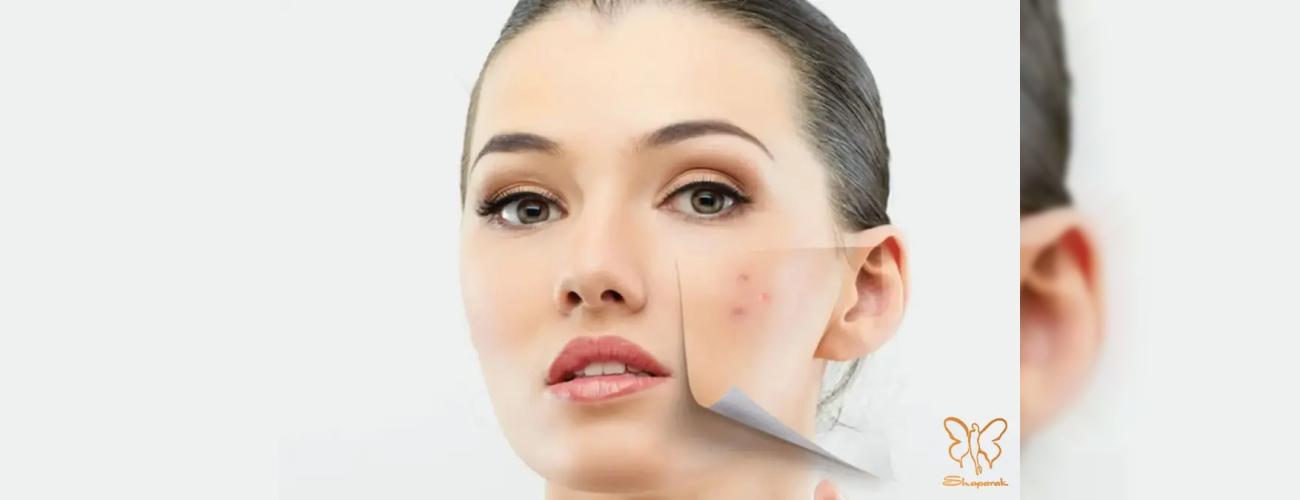 درمان ترکیبی لک‌های مقاوم صورت در مشهد | وقتی یک روش کافی نیست