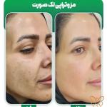 مصرف کشک و تقویت مو ، ناخن + درمان های تخصصی در مشهد