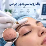 استفاده مداوم از لنز تماسی و مالیدن چشم؛ علت اصلی افتادگی زودرس پلک (پتوز اکتسابی) و چروک پنجه‌کلاغی