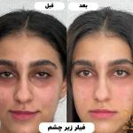 آسیب به پوست و مو با دخانیات و الکل: بررسی علمی در کلینیک شاپرک مشهد 