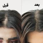 مصرف کشک و تقویت مو ، ناخن + درمان های تخصصی در مشهد