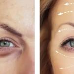 مزوژل جالپرو چیست ؟ تغذیه سلولی برای تولد دوباره پوست در مشهد