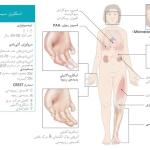 اسکلرودرمی و زیبایی: کدام خدمات (بوتاکس، ژل، لیزر) ممنوع و کدام مجاز است؟
