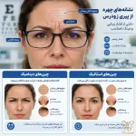 چروک عمیق خط اخم و پیشانی به خاطر نمره عینک اشتباه! وقتی چشم ضعیف، صورت را پیر می‌کند