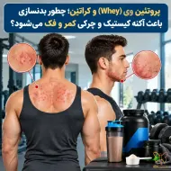 پروتئین وی (Whey) و کراتین، چطور بدنسازی باعث آکنه کیستیک و چرکی کمر و فک می‌شود؟