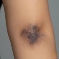 علت تیرگی آرنج چیست؟ بهترین روش‌های روشن کردن آن در مشهد کدامند؟