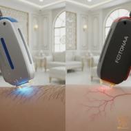 لیزر مو یا لیزر عروق؟ راز تشخیص هوشمند دستگاه‌های لیزر در کلینیک شاپرک