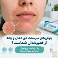 جوش‌های سرسخت دور دهان و چانه از خمیر دندان شماست؟ راز درماتیت پری‌اورال (Perioral Dermatitis)