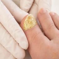 از شر زردی و شکنندگی ناخن پا خلاص شوید! (علائم و درمان قارچ ناخن پا)