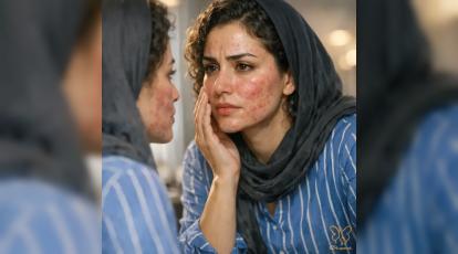 درمان خشکی و کدری پوست در فاکوماتوز رنگدانه‌ای؛ نبایدهای زیبایی که باید بدانید!