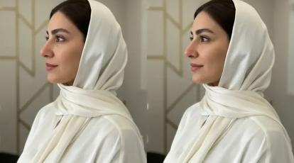 لیفت بینی با فیلر و بوتاکس: راز بینی خوش فرم در 15 دقیقه | کلینیک شاپرک طلایی مشهد