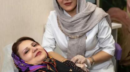 بلفاروپلاستی پلک بالا در مشهد