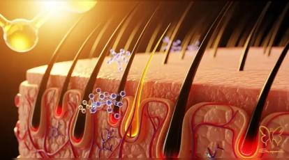 پروستیکا و مهار هورمون ریزش مو (DHT): بررسی ترکیب طلایی با PRP در مشهد