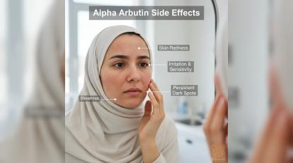 پشت پرده سرم‌های ضد لک: عوارض آلفا آربوتین و بهترین جایگزین‌های کلینیکی
