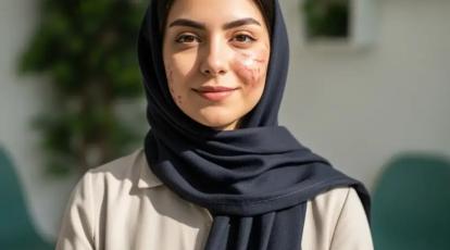 پایان کابوس جای سالک در مشهد | درمان قطعی و تخصصی در کلینیک شاپرک طلایی