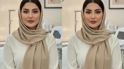 از بین بردن چربی های ناحیه بوکال فت بدون جراحی : با معجزه فوتونا آشنا شوید!