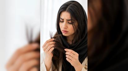 استرس موهای شما را پر از موخوره کرده؟ راهکار علمی و قطعی در مشهد