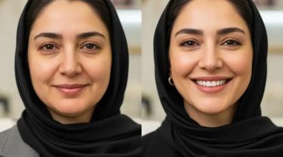 آیا لیفت با نخ برای شما مناسب است؟ پاسخ قطعی در بهترین کلینیک مشهد 