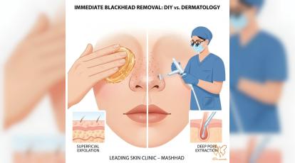 تخلیه فوری جوش سرسیاه بینی: آموزش اسکراب + معرفی بهترین کلینیک مشهد