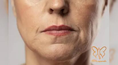 مراقبت های بعد از خدمات زیبایی با دستگاه های پیشرفته در کلینیک شاپرک مشهد 