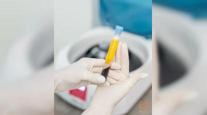 علت تیرگی زیر بغل چیست؟ + معرفی 4 روش درمانی موثر در کلینیک تخصصی شاپرک طلایی