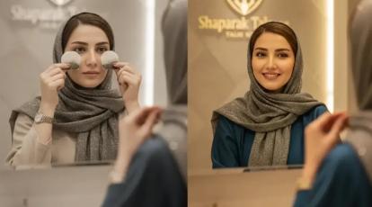 رفع پف زیر چشم: چای کیسه‌ای یا درمان تخصصی در مشهد؟ (راهنمای کامل شاپرک طلایی)