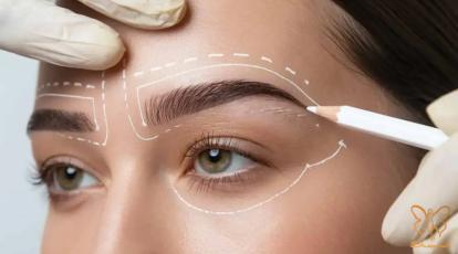انتخاب نهایی: کاشت ابرو نواری (FUT) بهتر است یا تار به تار (FUE/FIT)؟