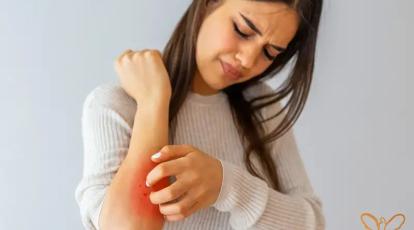 کهیر یا راش پوستی! انجام خدمات زیبایی و جوانسازی برای پوست های مستعد کهیر 