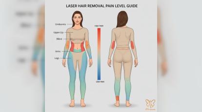 پردردترین و کم‌دردترین نواحی بدن برای لیزر مو زائد کدامند؟