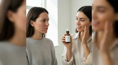 بررسی دلایل و مزایای شستشو پوست چرب و جوش دار با روغن +معرفی روغن مناسب