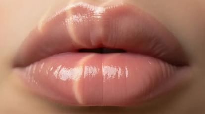 رهایی از ژل لب اردکی با آنزیم هیالاز در مشهد: زیبایی طبیعی خود را پس بگیرید!