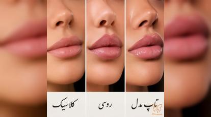 کدام مدل ژل لب به صورت من می‌آید؟ (مقایسه مدل روسی، نچرال و تاپ مدل) در شاپرک مشهد