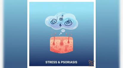ارتباط استرس و پسوریازیس: چگونه استرس پوست شما را بدتر می‌کند؟