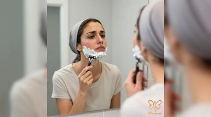 عوارض شیو صورت با ژیلت را می‌دانید؟ چرا لیزر کندلا بهترین راه حذف موها زائد صورت است؟