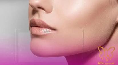 تزریق همزمان فیلر لب و چانه در مشهد | راز چهره‌ای متقارن در کلینیک شاپرک طلایی