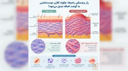 راز برجستگی زخم‌ها؛ چگونه کلاژن دوست‌داشتنی به گوشت اضافه تبدیل می‌شود؟