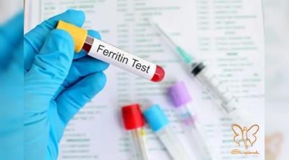 فریتین چیست؟ علت اصلی ریزش مو و خستگی‌های همیشگی که در آزمایش خون نادیده گرفته می‌شود!