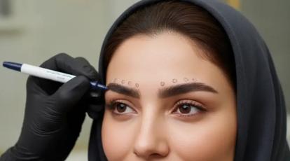 ابروهای افتاده در مشهد: صفر تا صد لیفت ابرو با بوتاکس و مقایسه با روش‌های خانگی