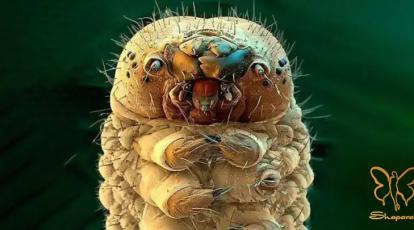 دمودکس چیست؟ آیا این مایت میکروسکوپی علت جوش و خارش پوست شماست؟